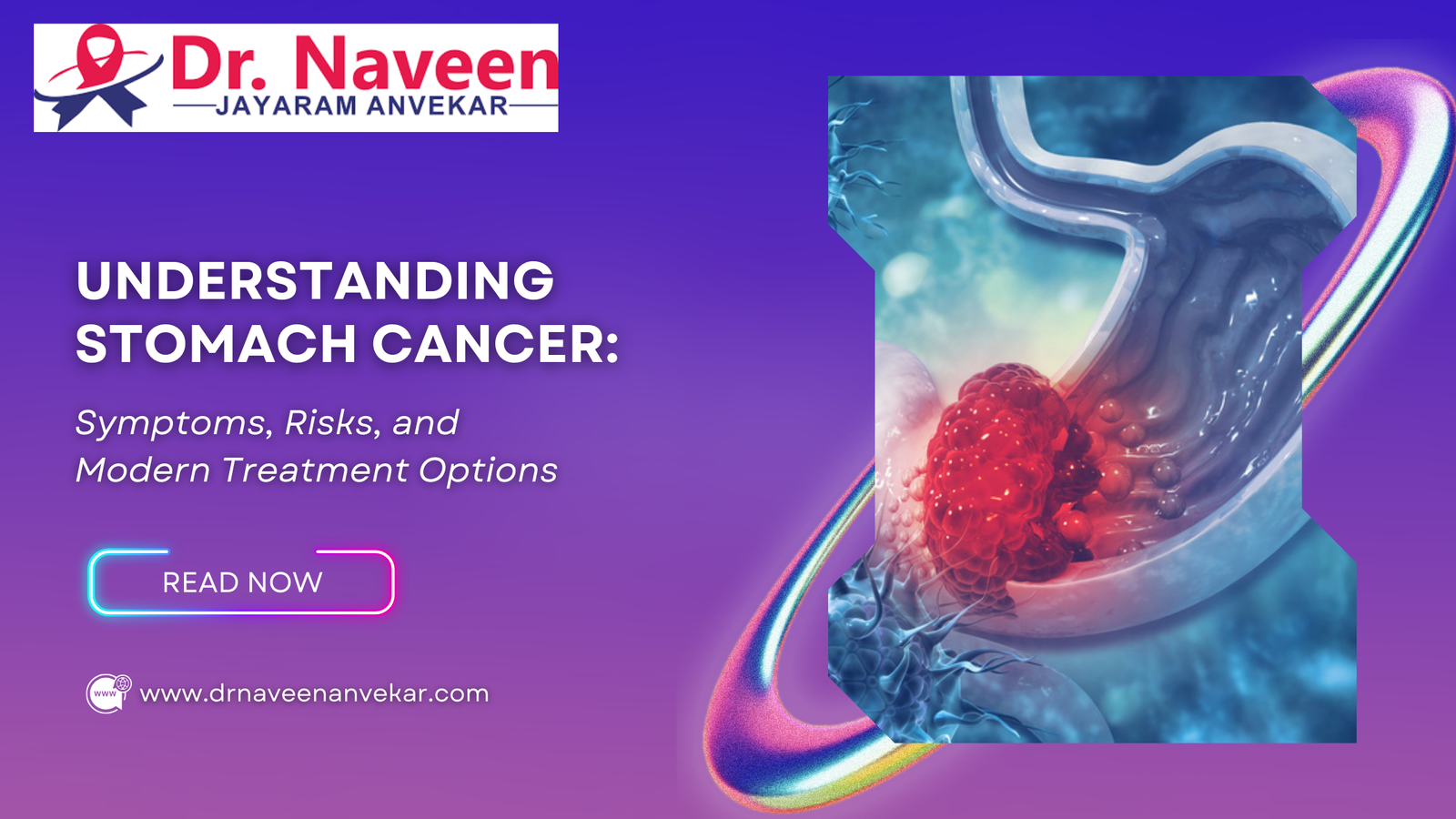 Understanding Stomach Cancer: Symptoms, Risks, and Modern Treatment Options